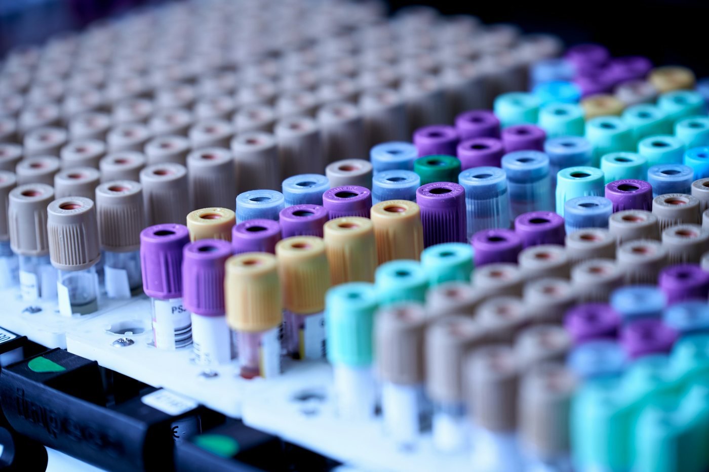 Rack of blood collection tubes in a laboratory, as used for hormone tests in adult acne
